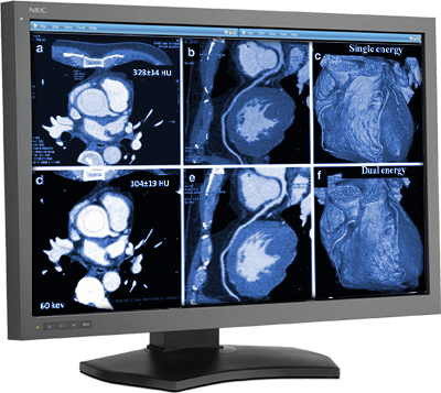 CT-Cardiac