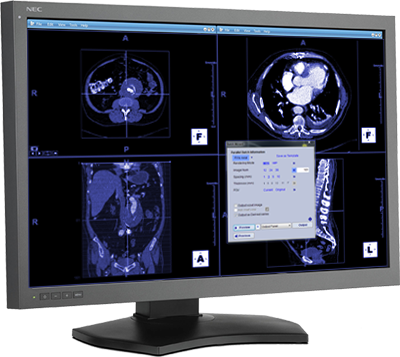 Volumetric Navigation
