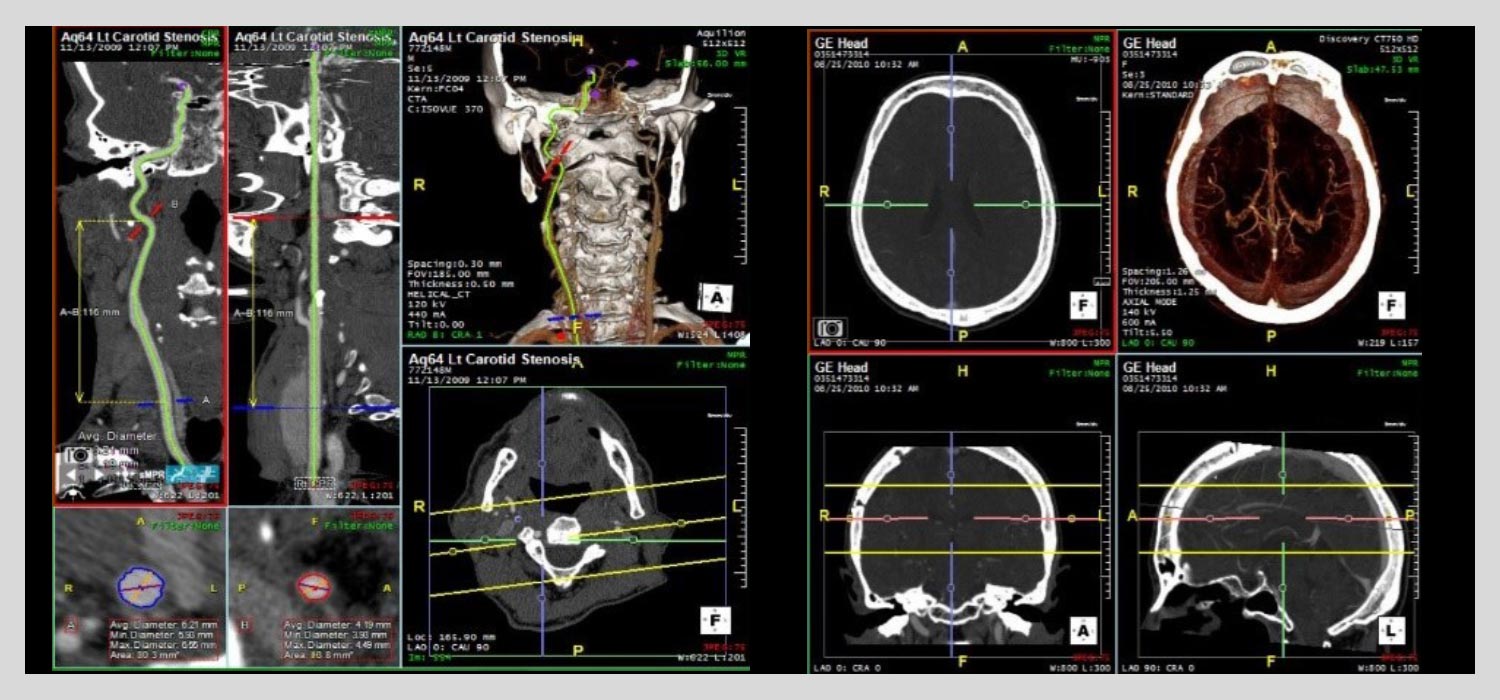 CT-Head-And-Neck-image CT-Head-And-Neck-image