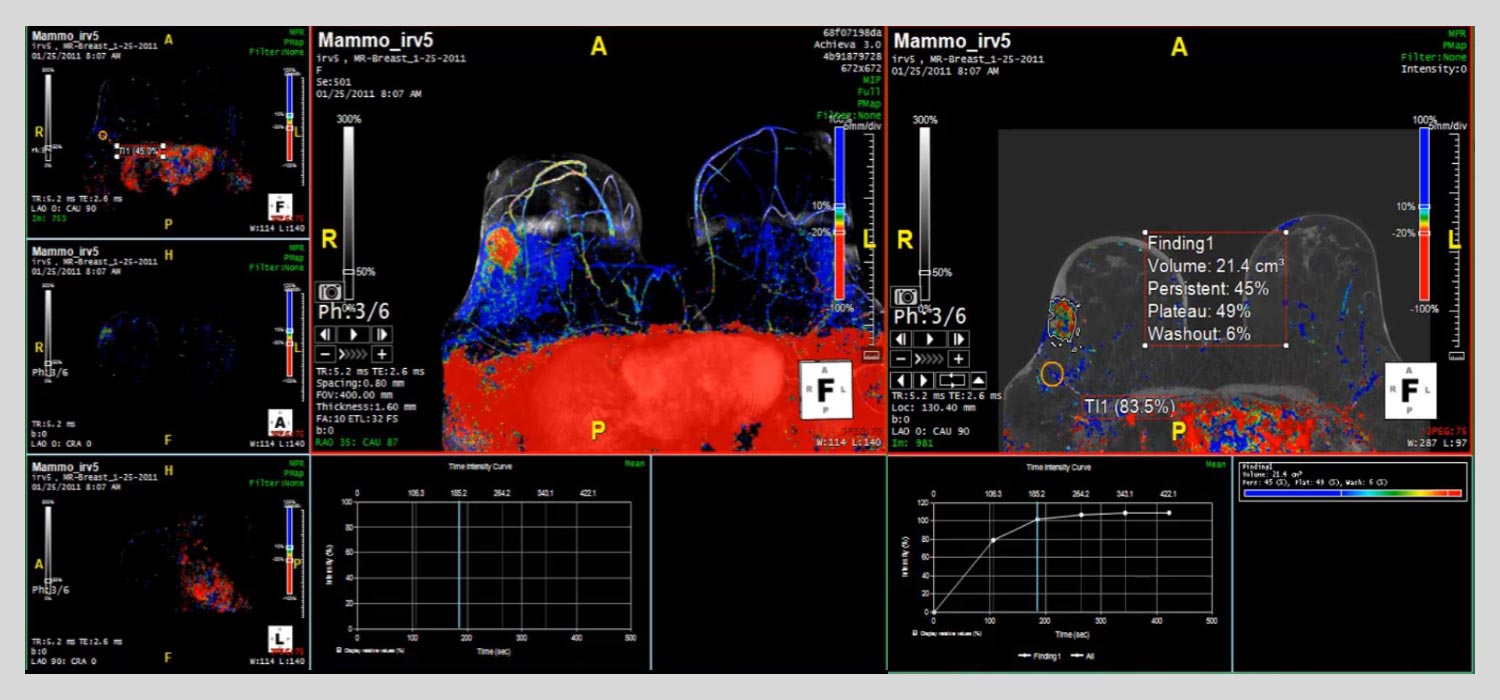MR-BODY-Image MR-BODY-Image
