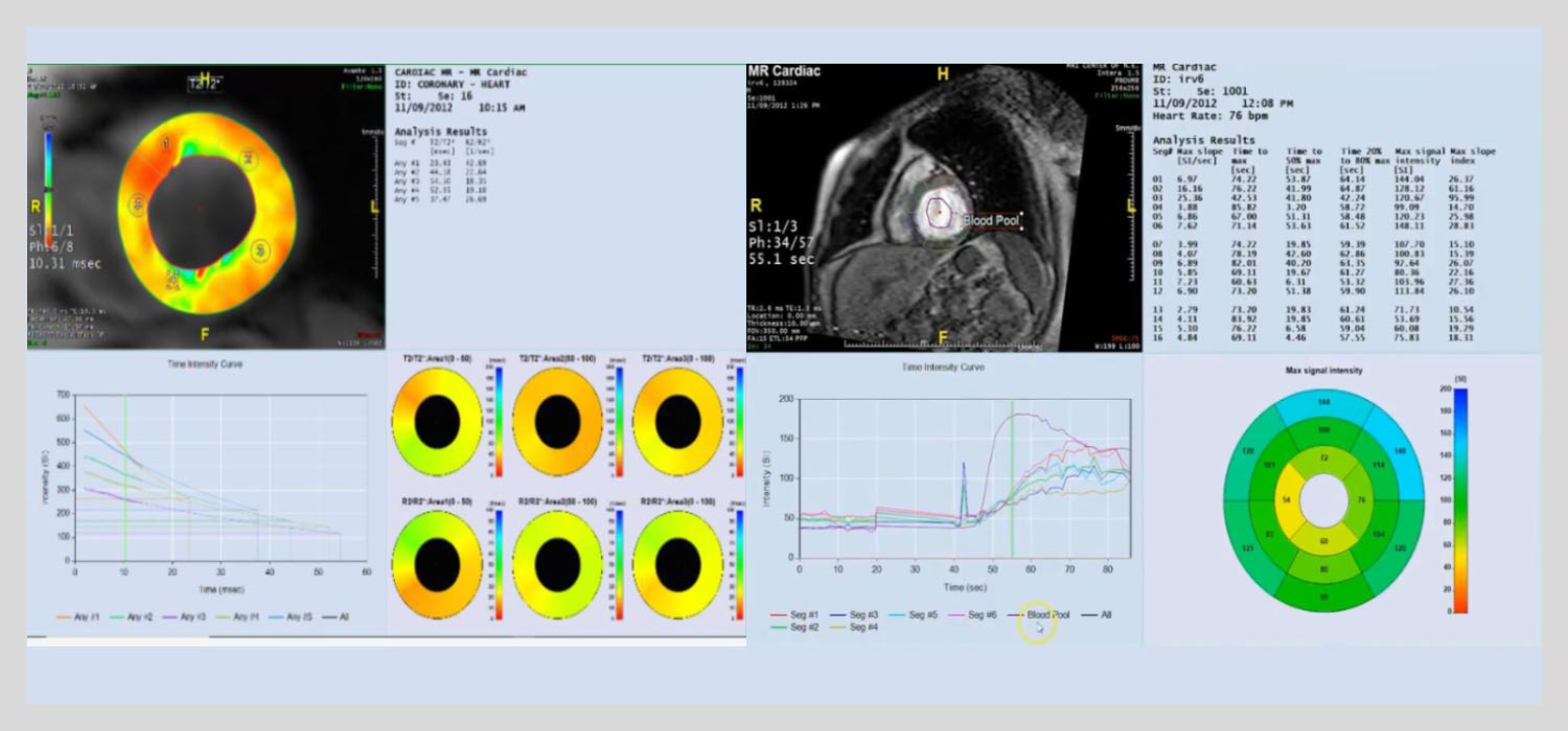 Mr-Cardiac-Image Mr-Cardiac-Image