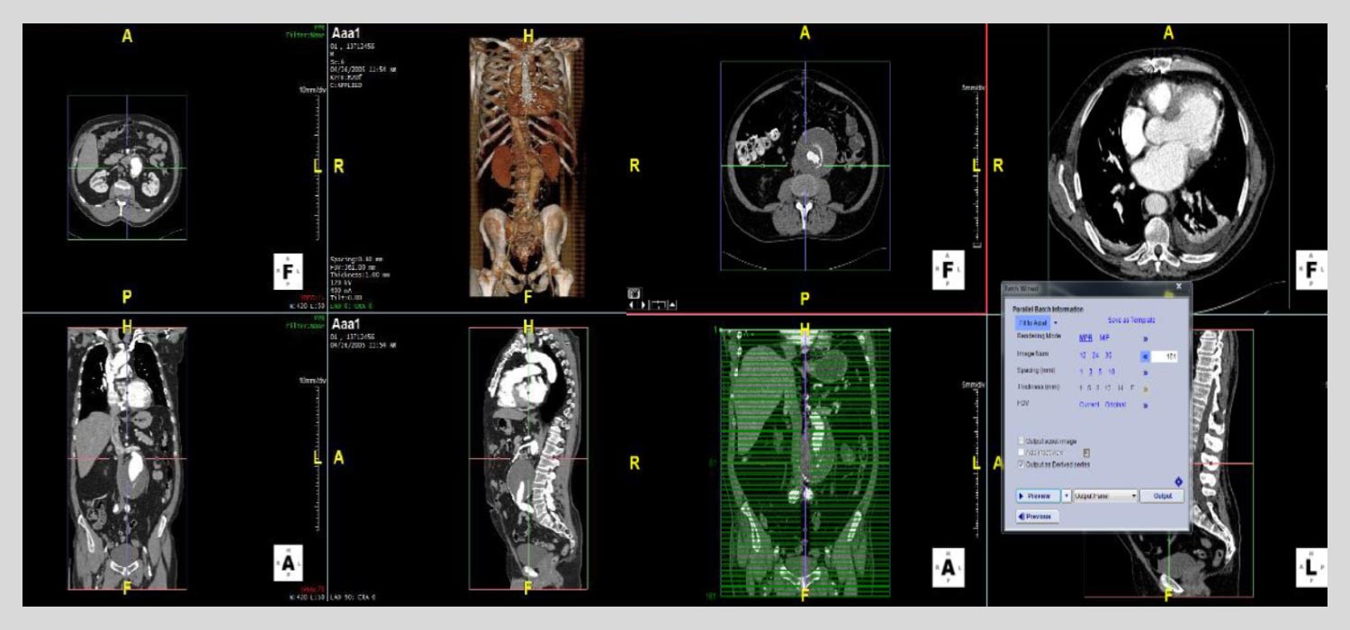 Volumetric-Navigation-Image Volumetric-Navigation-Image